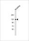Calcium Voltage-Gated Channel Auxiliary Subunit Alpha2delta 2 antibody, 57-021, ProSci, Western Blot image 