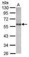 Carbohydrate Sulfotransferase 9 antibody, GTX116917, GeneTex, Western Blot image 