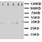 Oxidized Low Density Lipoprotein Receptor 1 antibody, orb76345, Biorbyt, Western Blot image 