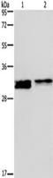FOS Like 1, AP-1 Transcription Factor Subunit antibody, TA321715, Origene, Western Blot image 