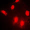 rIPK1 antibody, LS-C353526, Lifespan Biosciences, Immunofluorescence image 