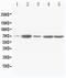 Succinate dehydrogenase [ubiquinone] flavoprotein subunit, mitochondrial antibody, PA5-79962, Invitrogen Antibodies, Western Blot image 