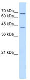 Aldehyde Dehydrogenase 3 Family Member A2 antibody, TA335228, Origene, Western Blot image 