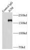 Alpha-2-Macroglobulin antibody, FNab00340, FineTest, Immunoprecipitation image 