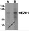 Histone-lysine N-methyltransferase EZH1 antibody, 6261, ProSci Inc, Western Blot image 