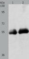 Sodium-iodide symporter antibody, TA321132, Origene, Western Blot image 