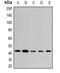 ST8 Alpha-N-Acetyl-Neuraminide Alpha-2,8-Sialyltransferase 2 antibody, orb382059, Biorbyt, Western Blot image 