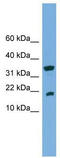 Acid Phosphatase antibody, TA346451, Origene, Western Blot image 