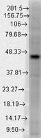 DNA Methyltransferase 3 Like antibody, TA326396, Origene, Western Blot image 