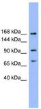 ADAM Metallopeptidase With Thrombospondin Type 1 Motif 19 antibody, TA345497, Origene, Western Blot image 