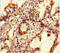 Extracellular sulfatase Sulf-1 antibody, CSB-PA814217LA01HU, Cusabio, Immunohistochemistry paraffin image 
