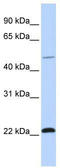 WW Domain Containing E3 Ubiquitin Protein Ligase 2 antibody, TA329809, Origene, Western Blot image 