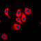 Mitogen-Activated Protein Kinase 8 Interacting Protein 2 antibody, LS-C353357, Lifespan Biosciences, Immunofluorescence image 