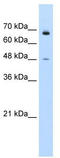 Kelch Like Family Member 25 antibody, TA337249, Origene, Western Blot image 