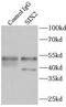 Homeobox protein SIX2 antibody, FNab07887, FineTest, Immunoprecipitation image 