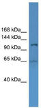 Ubiquitin Like Modifier Activating Enzyme 6 antibody, TA342595, Origene, Western Blot image 