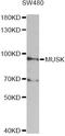 Muscle Associated Receptor Tyrosine Kinase antibody, STJ24645, St John