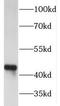 Farnesyltransferase, CAAX Box, Alpha antibody, FNab03180, FineTest, Western Blot image 