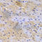 Sarcoglycan Epsilon antibody, A5330, ABclonal Technology, Immunohistochemistry paraffin image 