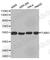 Tubulin Beta 3 Class III antibody, A2628, ABclonal Technology, Western Blot image 