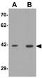 Solute Carrier Family 35 Member D2 antibody, GTX32037, GeneTex, Western Blot image 