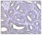 Nuclear distribution protein nudE-like 1 antibody, A02478-2, Boster Biological Technology, Immunohistochemistry paraffin image 