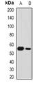 Secreted frizzled-related protein 4 antibody, orb382033, Biorbyt, Western Blot image 