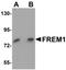 FRAS1 Related Extracellular Matrix 1 antibody, orb94722, Biorbyt, Western Blot image 