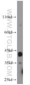 Tripartite Motif Containing 63 antibody, 55456-1-AP, Proteintech Group, Western Blot image 