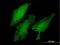 LIM domain only protein 3 antibody, H00055885-M03, Novus Biologicals, Immunofluorescence image 