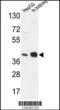 NADH:Ubiquinone Oxidoreductase Subunit A10 antibody, 64-102, ProSci, Western Blot image 
