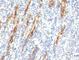 CD34 antibody, V2999IHC-7ML, NSJ Bioreagents, Immunohistochemistry frozen image 