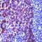 Keratin 5 antibody, PA1-37974, Invitrogen Antibodies, Immunohistochemistry frozen image 