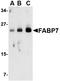 Mitogen-activated protein kinase 7 antibody, orb5183, Biorbyt, Western Blot image 