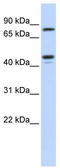 Carbohydrate Sulfotransferase 6 antibody, TA346811, Origene, Western Blot image 