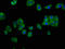 Interleukin 12 Receptor Subunit Beta 2 antibody, LS-C672013, Lifespan Biosciences, Immunofluorescence image 