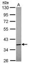 Annexin A8 antibody, GTX119471, GeneTex, Western Blot image 