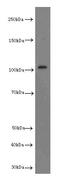 X-linked retinitis pigmentosa GTPase regulator antibody, abx115144, Abbexa, Enzyme Linked Immunosorbent Assay image 