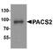 Phosphofurin Acidic Cluster Sorting Protein 2 antibody, TA349176, Origene, Western Blot image 