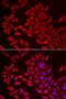 1-Acylglycerol-3-Phosphate O-Acyltransferase 2 antibody, LS-C334771, Lifespan Biosciences, Immunofluorescence image 