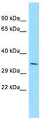 Oligodendrocyte Transcription Factor 2 antibody, TA331142, Origene, Western Blot image 