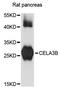 Chymotrypsin-like elastase family member 3B antibody, LS-C748746, Lifespan Biosciences, Western Blot image 