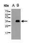 KChIP3 antibody, PA5-28330, Invitrogen Antibodies, Western Blot image 