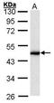 Keratin-16 antibody, GTX100838, GeneTex, Western Blot image 