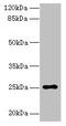 Actin Related Protein 2/3 Complex Inhibitor antibody, CSB-PA773801LA01HU, Cusabio, Western Blot image 