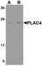 Placenta-specific protein 4 antibody, A15552, Boster Biological Technology, Western Blot image 