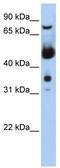 CDK-activating kinase assembly factor MAT1 antibody, TA330174, Origene, Western Blot image 