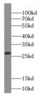GC-A antibody, FNab03630, FineTest, Western Blot image 