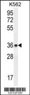 ETS translocation variant 2 antibody, 55-776, ProSci, Western Blot image 