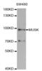 Muscle Associated Receptor Tyrosine Kinase antibody, abx002025, Abbexa, Western Blot image 